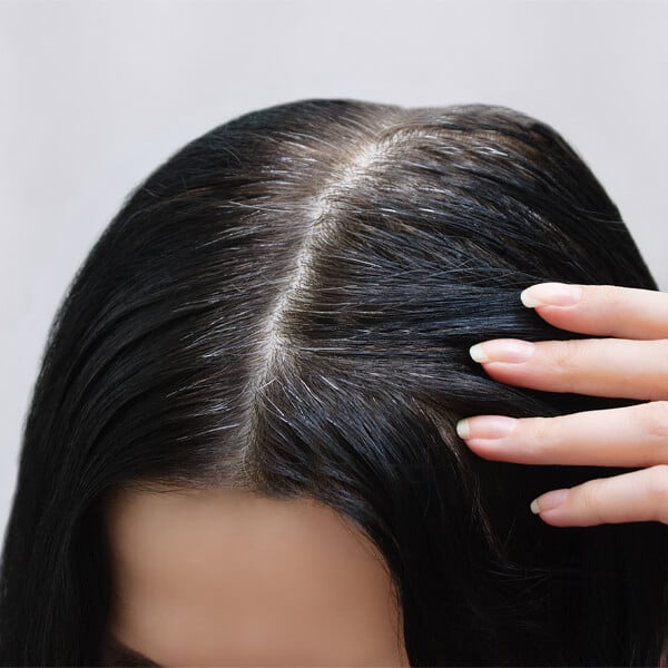 Grey Hair to Natural Color Permanently in 40 Days  Health