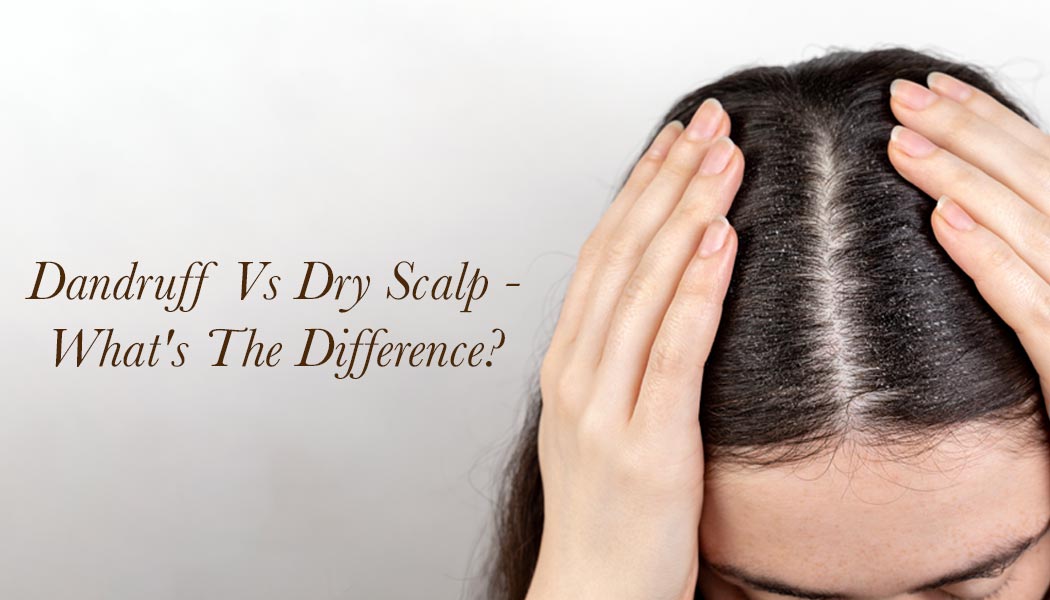 Dandruff Vs Dry Scalp – What’s The Difference?