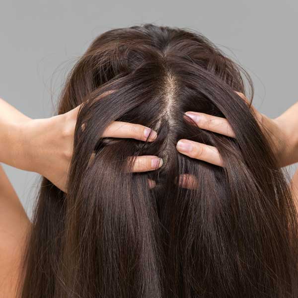 Conditions That Cause Hair Loss in Children  Hair Loss Center  Everyday  Health